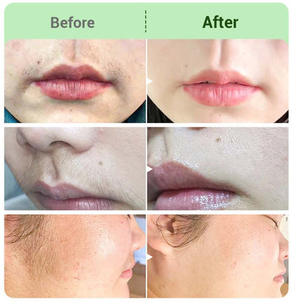 ⚡ LAST DAY PROMOTION - BUY 1 GET 2 FREE⚡Hair Removal Cream Kit for Women💛💛