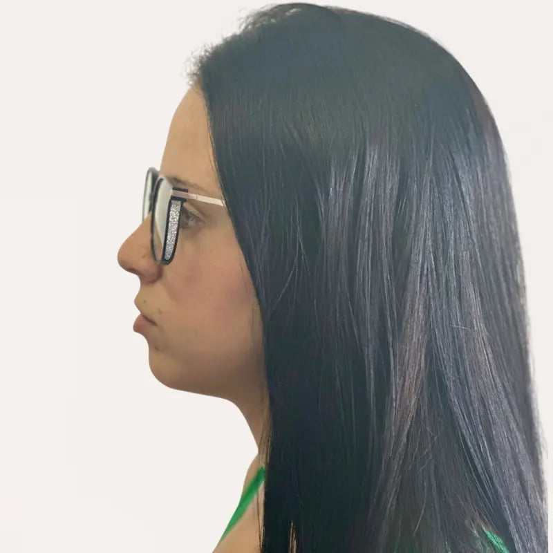 Gafas Multifocales Crystal Elite Vision
