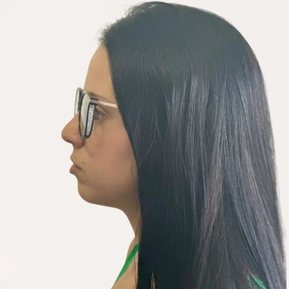 Gafas Multifocales Crystal Elite Vision