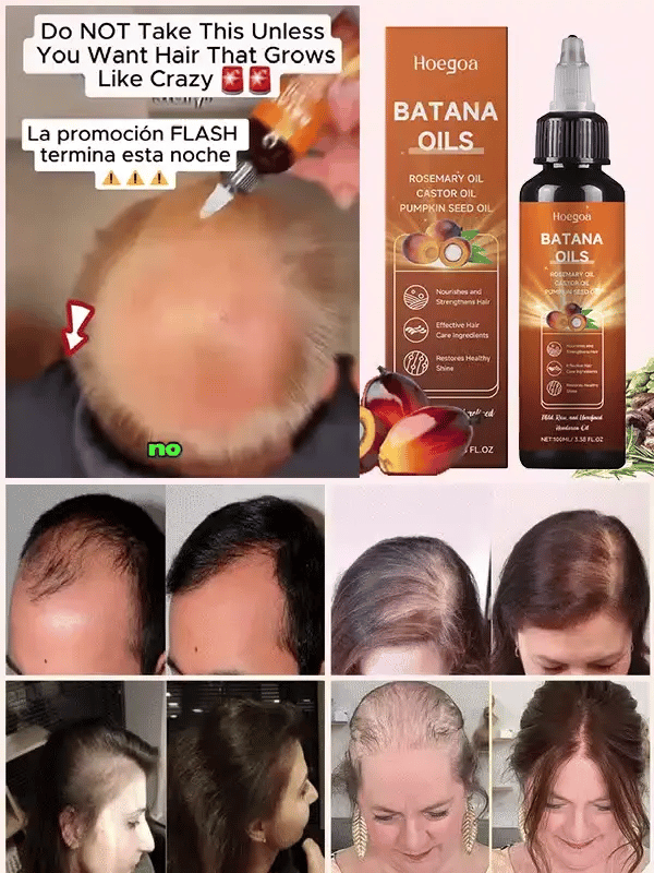 Clinical-grade anti-hair loss and hair growth serum