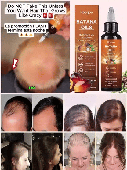 Clinical-grade anti-hair loss and hair growth serum