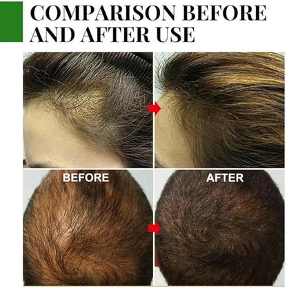 Rosemary Hair Care Essential Oil