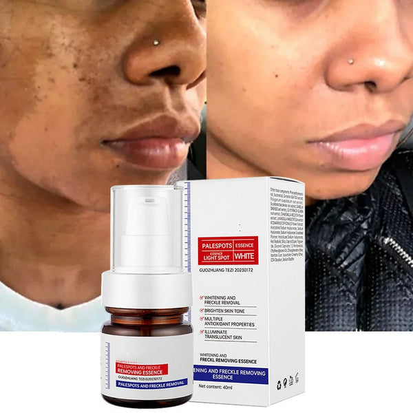 ⚡5-second brightening！Vitamin C Whitening Freckles ESSENCE