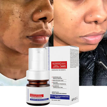 ⚡5-second brightening！Vitamin C Whitening Freckles ESSENCE