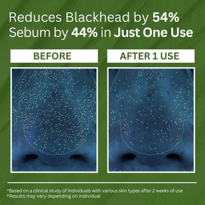 P.CALM Holy Basil Carbonated Mask: Transforming Clay-to-Bubbles Deep Pore Cleanser, Blackhead & Sebum Control, 90g Spa Experience Makeup Organizers
