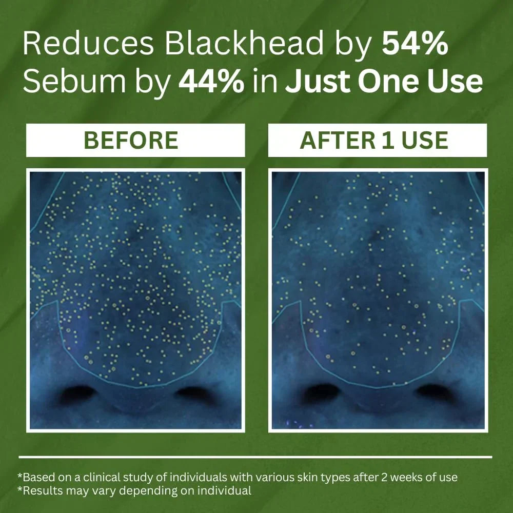 P.CALM Holy Basil Carbonated Mask: Transforming Clay-to-Bubbles Deep Pore Cleanser, Blackhead & Sebum Control, 90g Spa Experience Makeup Organizers