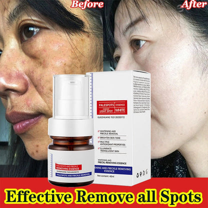 ⚡5-second brightening！Vitamin C Whitening Freckles ESSENCE