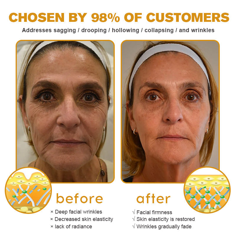 (Made and Shipped from USA) 🧑‍⚕️TLOPA® Botox Bee Venom Wrinkle Removal Cream🔥