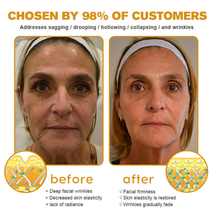 (Made and Shipped from USA) 🧑‍⚕️TLOPA® Botox Bee Venom Wrinkle Removal Cream🔥