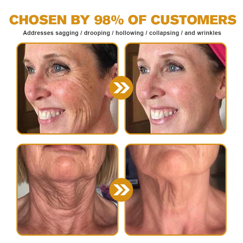 (Made and Shipped from USA) 🧑‍⚕️TLOPA® Botox Bee Venom Wrinkle Removal Cream🔥
