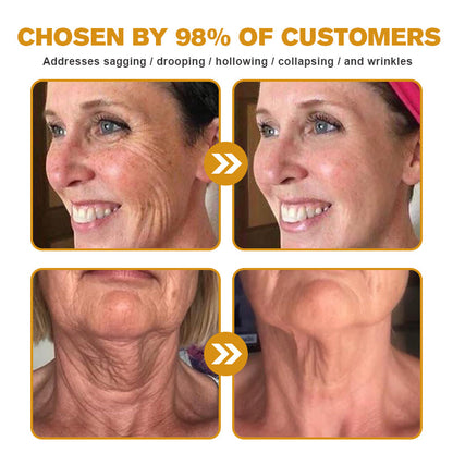 (Made and Shipped from USA) 🧑‍⚕️TLOPA® Botox Bee Venom Wrinkle Removal Cream🔥