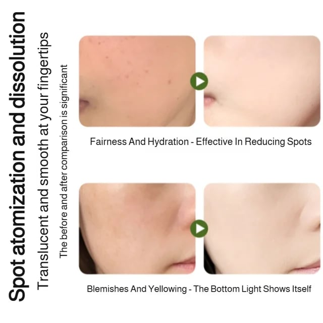 Whitening Moisturizing Essence Spray
