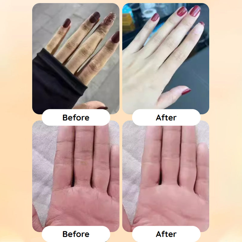 🥳2026 HOT SALE💞50K+ SOLD!💧50% OFF🌸Fresh Hydrating Hand Cream – Instant relief for dry hands! Deep moisture that lasts, leaving skin soft & supple all day. 🌿🤲