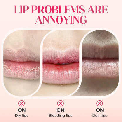 ⏳2026 NEW YEAR BUY 1 GET 1 FREE⚡50K+ SOLD!✨Nooni Apple Hydrating Moisturizer Plump Transfer-proof Glossy Lip Stain Oil💋