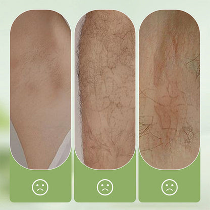 🎉This Week's Special Sales ✨Gentle and Non-Irritating Hair Removal Cream